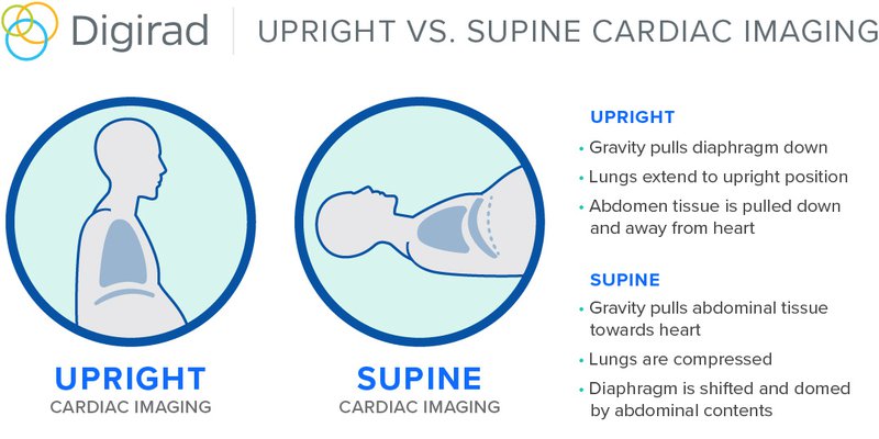 3 Ways Upright Cardiac Imaging Is Different From Supine
